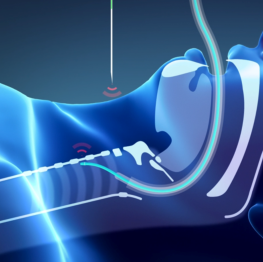 A stylised image of a see through body model in blue lines showing a tube being inserted down the windpipe